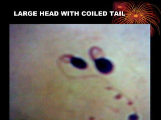 LARGE HEAD WITH COILED TAIL 