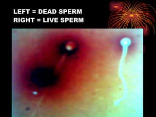 LEFT = DEAD SPERM RIGHT = LIVE SPERM 