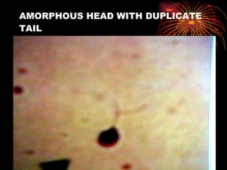 AMORPHOUS HEAD WITH DUPLICATE TAIL 