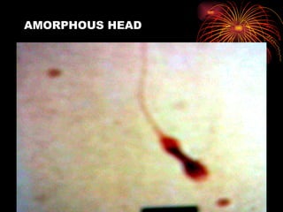 AMORPHOUS HEAD 