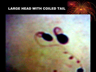 LARGE HEAD WITH COILED TAIL 