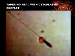 TAPERING HEAD WITH CYTOPLASMIC DROPLET 