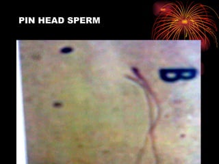 PIN HEAD SPERM 