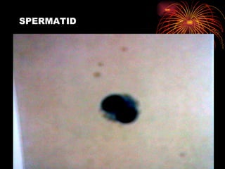 SPERMATID 
