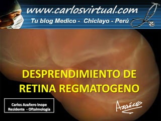 DESPRENDIMIENTO DE RETINA REGMATOGENO Carlos Azañero Inope Residente  - Oftalmología 