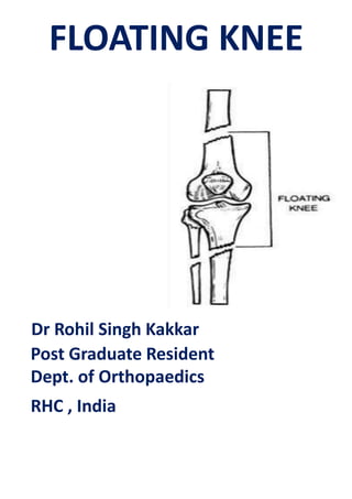 FLOATING KNEE
Dr Rohil Singh Kakkar
Post Graduate Resident
Dept. of Orthopaedics
RHC , India
 