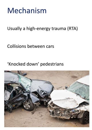 Floating Knee | PPTX