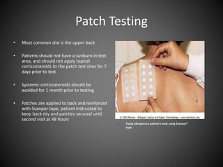 Patch Day Testing UPDATE ON CONTACT DERMATITIS | PPTX