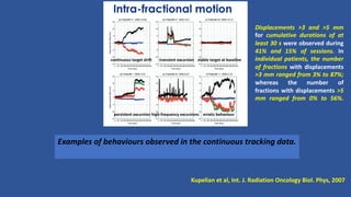 Examples of behaviours observed in the continuous tracking data.
Kupelian et al, Int. J. Radiation Oncology Biol. Phys, 2007
Displacements >3 and >5 mm
for cumulative durations of at
least 30 s were observed during
41% and 15% of sessions. In
individual patients, the number
of fractions with displacements
>3 mm ranged from 3% to 87%;
whereas the number of
fractions with displacements >5
mm ranged from 0% to 56%.
continuous target drift transient excursion stable target at baseline
persistent excursion high-frequency excursions erratic behaviour
 