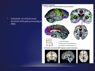 •

Schematic of cortical areas
involved with pain processing and
fMRI

 