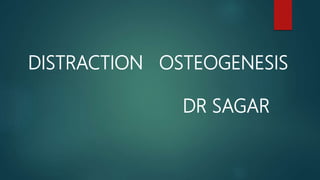 DISTRACTION OSTEOGENESIS
DR SAGAR
 