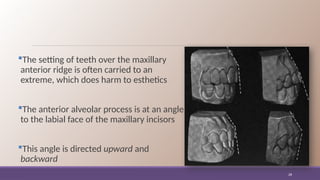 Dr Samia 3.6.15 Positioning of Teeth for Complete Dentures.pptx