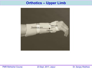 Orthotics – Upper Limb
PMR Refresher Course 23 Sept. 2017, Jaipur Dr. Sanjay Wadhwa
 