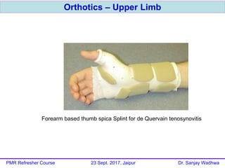Orthotics – Upper Limb
PMR Refresher Course 23 Sept. 2017, Jaipur Dr. Sanjay Wadhwa
Forearm based thumb spica Splint for de Quervain tenosynovitis
 