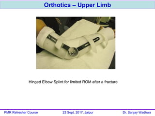 Orthotics – Upper Limb
PMR Refresher Course 23 Sept. 2017, Jaipur Dr. Sanjay Wadhwa
Hinged Elbow Splint for limited ROM after a fracture
 
