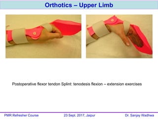 Orthotics – Upper Limb
PMR Refresher Course 23 Sept. 2017, Jaipur Dr. Sanjay Wadhwa
Postoperative flexor tendon Splint: tenodesis flexion – extension exercises
 