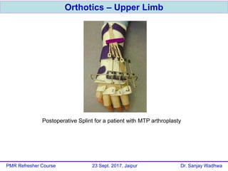 Orthotics – Upper Limb
PMR Refresher Course 23 Sept. 2017, Jaipur Dr. Sanjay Wadhwa
Postoperative Splint for a patient with MTP arthroplasty
 
