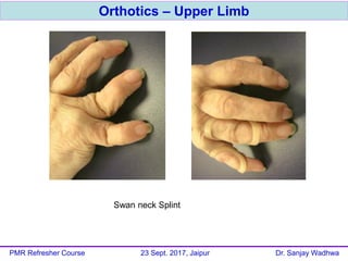 Orthotics – Upper Limb
PMR Refresher Course 23 Sept. 2017, Jaipur Dr. Sanjay Wadhwa
Swan neck Splint
 