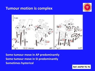 ABC system, Free Breath 4DCT & Symmetry Radiotherapy | PDF