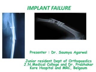 IMPLANT FAILURE
Presenter : Dr. Saumya Agarwal
Junior resident Dept of Orthopaedics
J.N.Medical College and Dr. Prabhakar
Kore Hospital and MRC, Belgaum
 