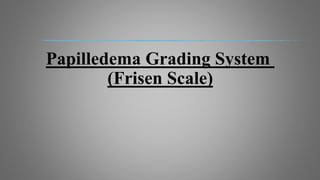 Papilledema Grading System
(Frisen Scale)
 