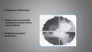  Enlargment of blind spot.
 Earliest loss of visual field
commonly involves inferior
nasal quadrent.
 Peripheral concentric
constriction.
 
