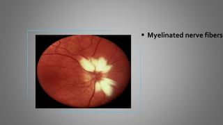  Myelinated nerve fibers
 