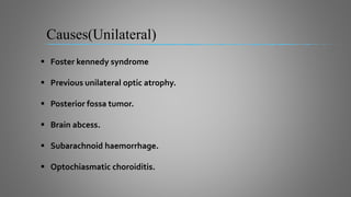 Causes(Unilateral)
 Foster kennedy syndrome
 Previous unilateral optic atrophy.
 Posterior fossa tumor.
 Brain abcess.
 Subarachnoid haemorrhage.
 Optochiasmatic choroiditis.
 