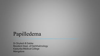 Papilledema
Dr Shylesh B Dabke
Resident Dept. of Ophthalmology
Kasturba Medical College
Mangalore
 