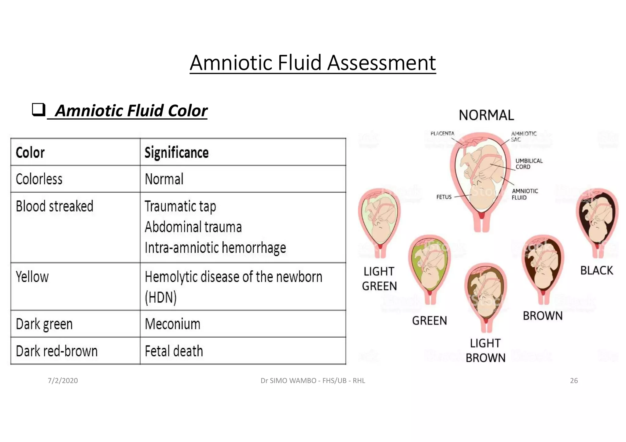 Vip Edition What Colour Is Amniotic Fluid When It Leaks