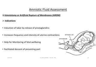 Dr Simo - Fetal Distress and Neonatal Asphyxia.pdf