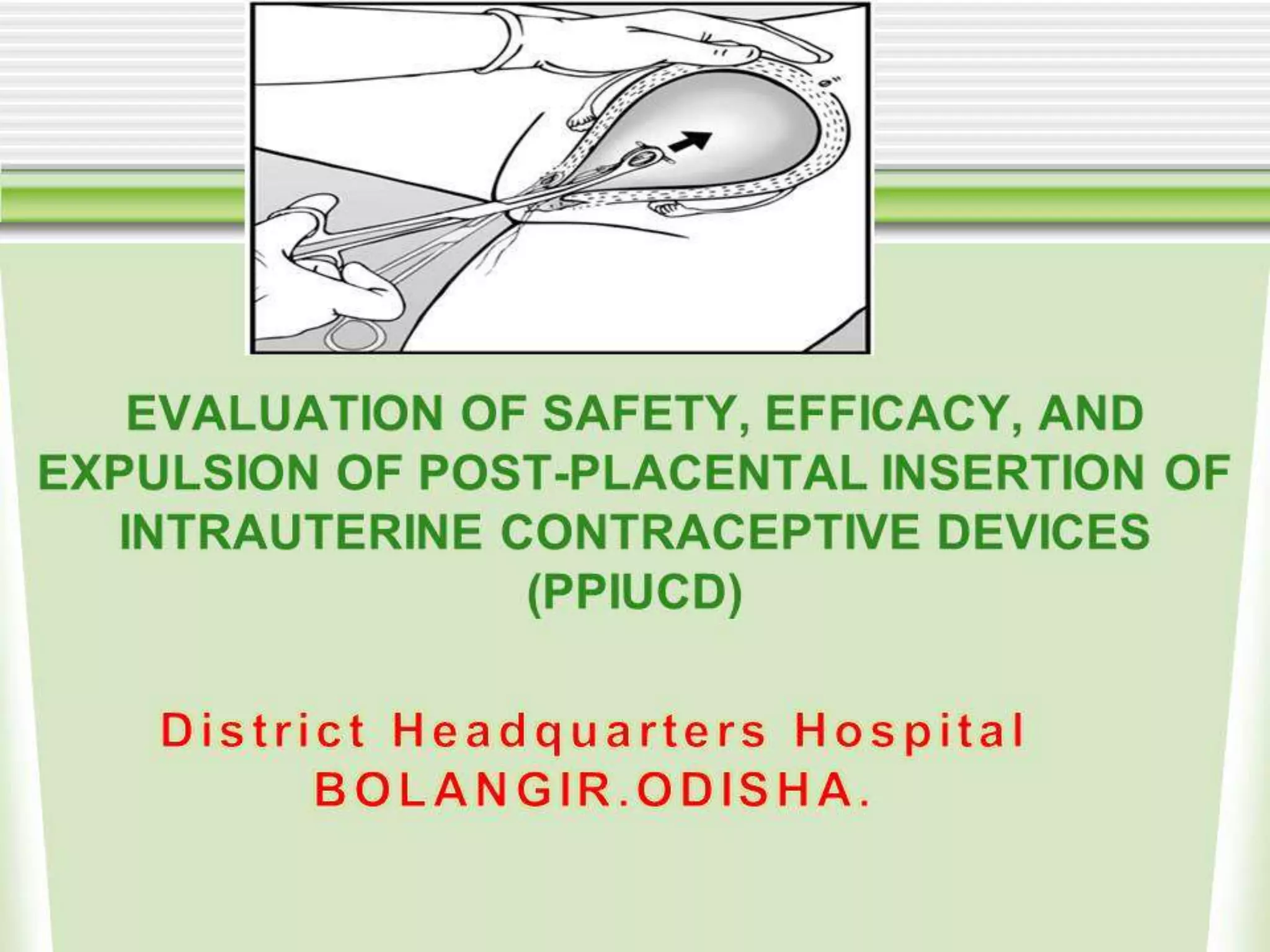 Evaluation of safety, efficacy, and expulsion of PPIUCD