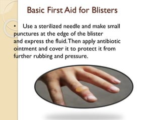 Basic First Aid for Blisters
• Use a sterilized needle and make small
punctures at the edge of the blister
and express the fluid.Then apply antibiotic
ointment and cover it to protect it from
further rubbing and pressure.
 