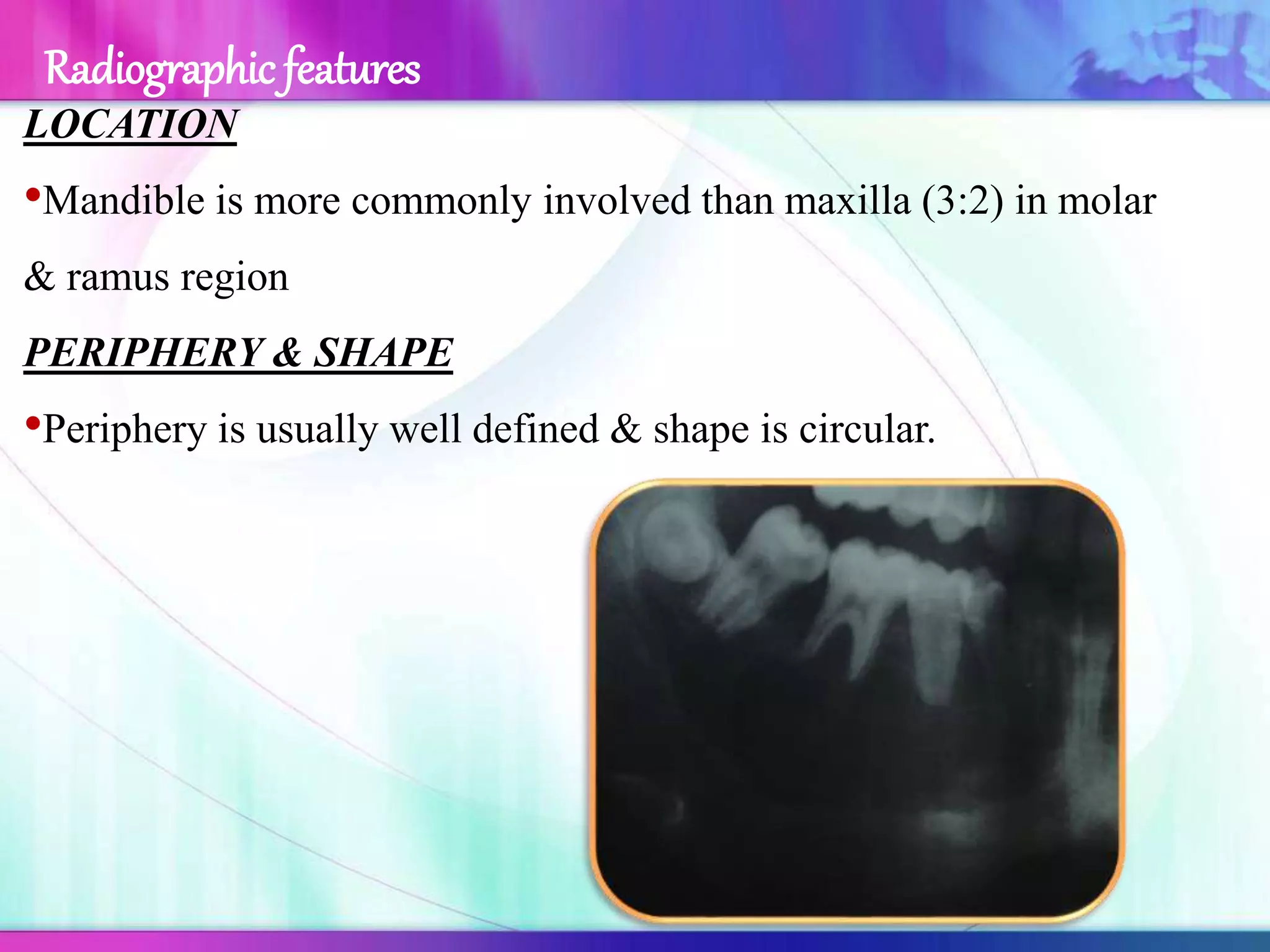 LOCATION
•Mandible is more commonly involved than maxilla (3:2) in molar
& ramus region
PERIPHERY & SHAPE
•Periphery is usually well defined & shape is circular.
Radiographic features
 