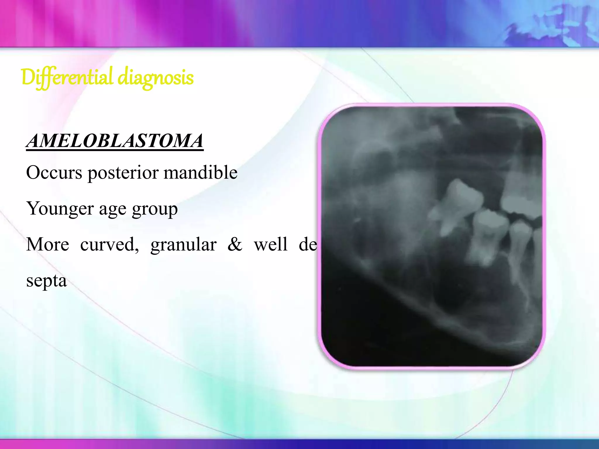 Differential diagnosis
AMELOBLASTOMA
Occurs posterior mandible
Younger age group
More curved, granular & well defined
septa
 