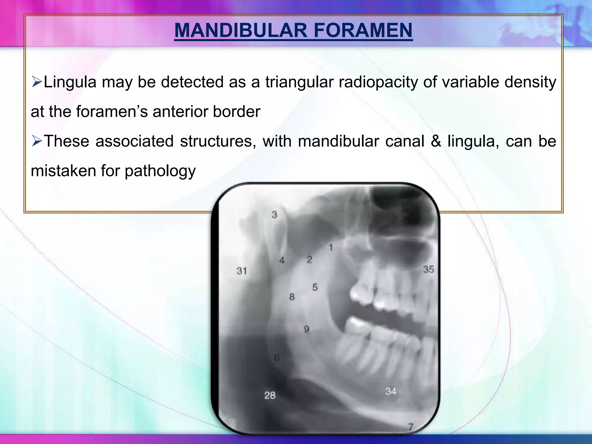 MANDIBULAR FORAMEN
Lingula may be detected as a triangular radiopacity of variable density
at the foramen’s anterior border
These associated structures, with mandibular canal & lingula, can be
mistaken for pathology
 