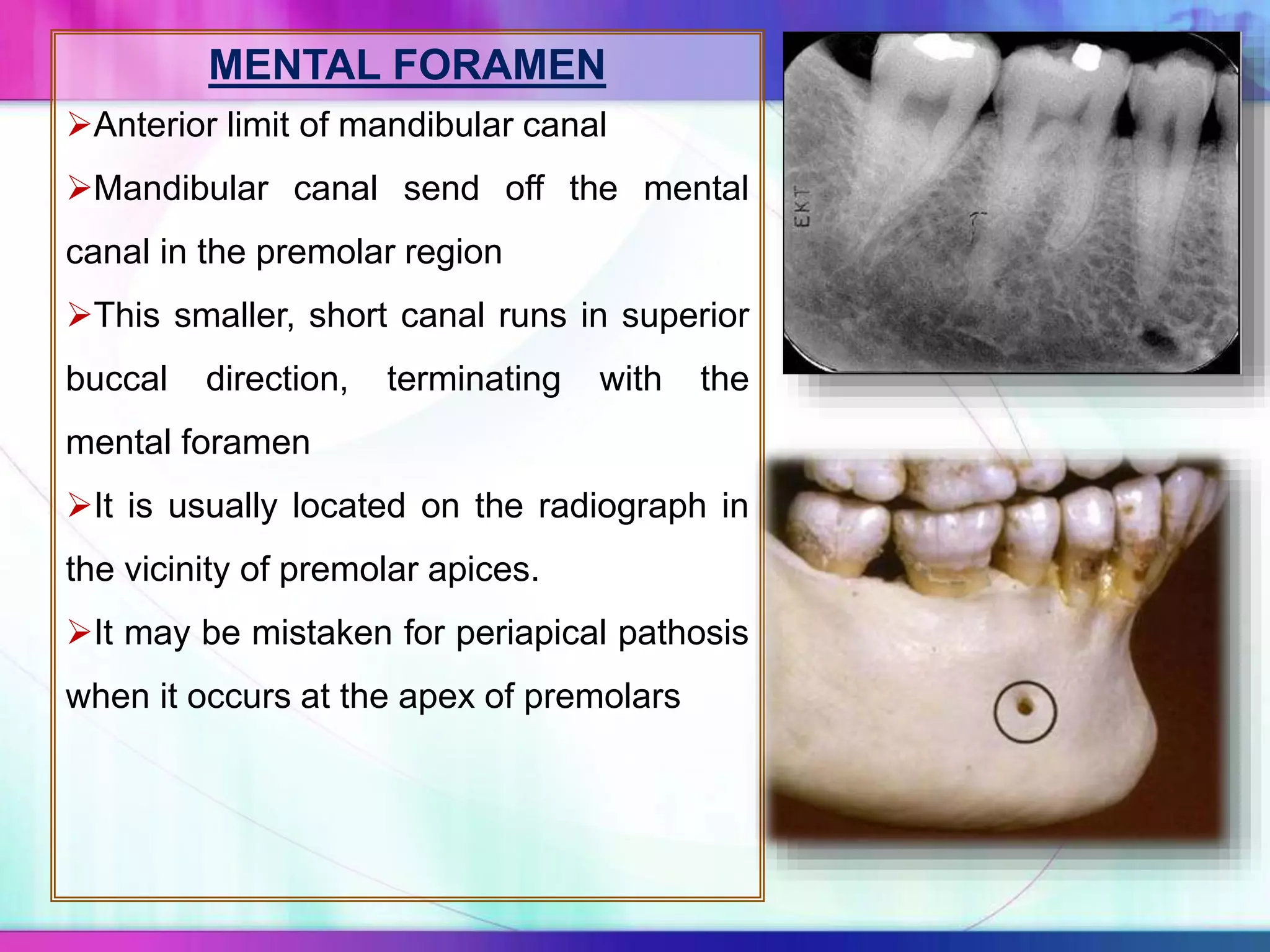 MENTAL FORAMEN
Anterior limit of mandibular canal
Mandibular canal send off the mental
canal in the premolar region
This smaller, short canal runs in superior
buccal direction, terminating with the
mental foramen
It is usually located on the radiograph in
the vicinity of premolar apices.
It may be mistaken for periapical pathosis
when it occurs at the apex of premolars
 