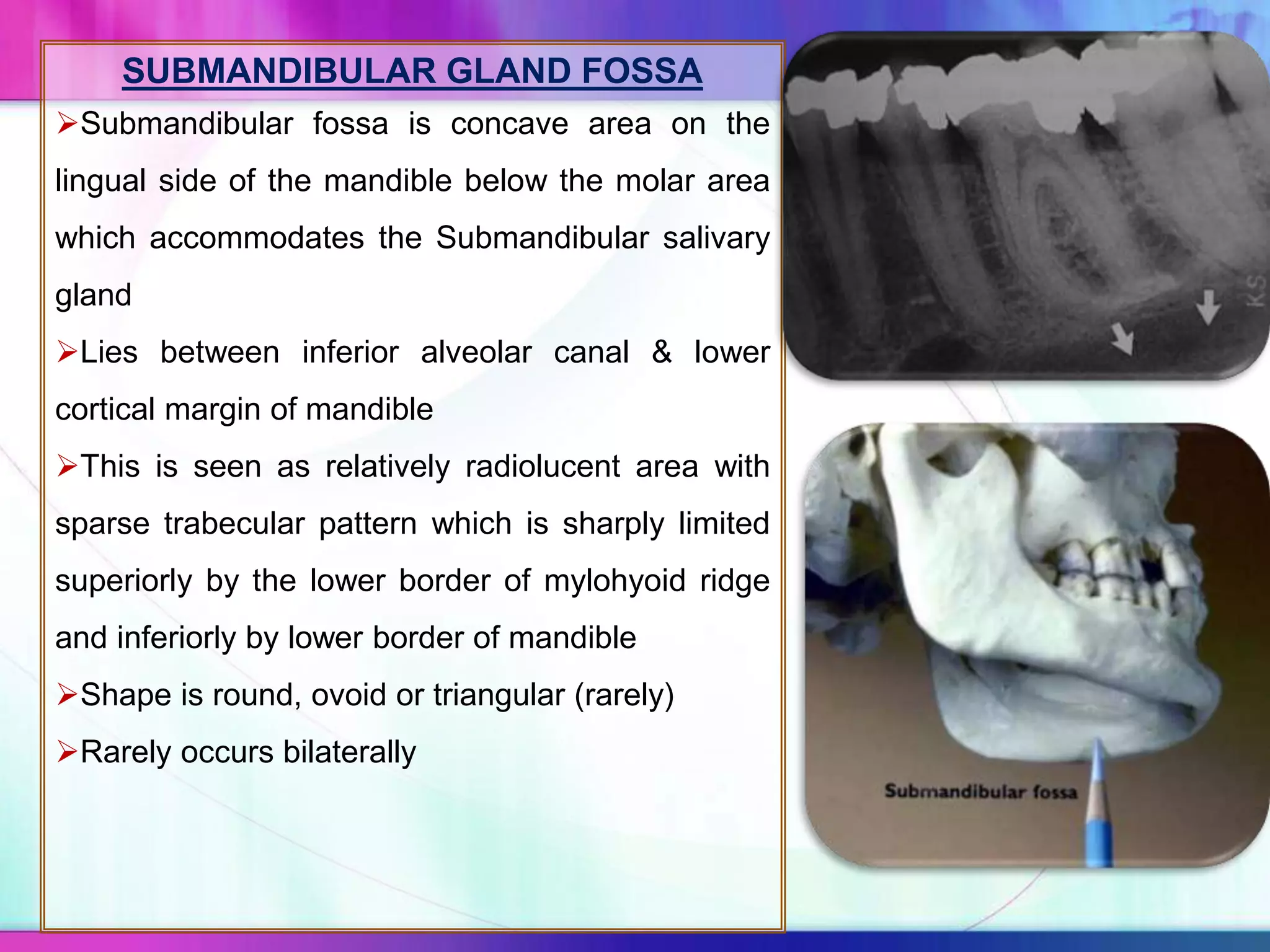 SUBMANDIBULAR GLAND FOSSA
Submandibular fossa is concave area on the
lingual side of the mandible below the molar area
which accommodates the Submandibular salivary
gland
Lies between inferior alveolar canal & lower
cortical margin of mandible
This is seen as relatively radiolucent area with
sparse trabecular pattern which is sharply limited
superiorly by the lower border of mylohyoid ridge
and inferiorly by lower border of mandible
Shape is round, ovoid or triangular (rarely)
Rarely occurs bilaterally
 