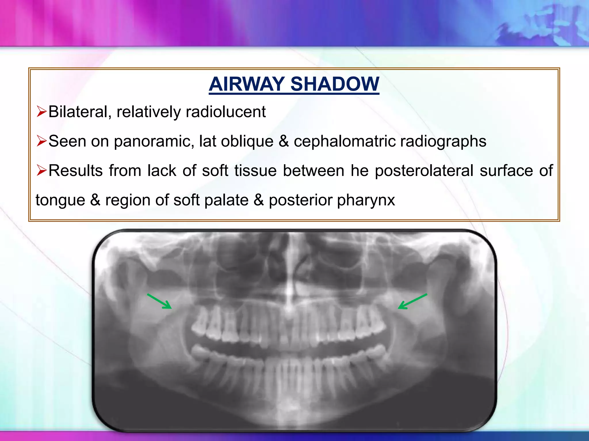 AIRWAY SHADOW
Bilateral, relatively radiolucent
Seen on panoramic, lat oblique & cephalomatric radiographs
Results from lack of soft tissue between he posterolateral surface of
tongue & region of soft palate & posterior pharynx
 