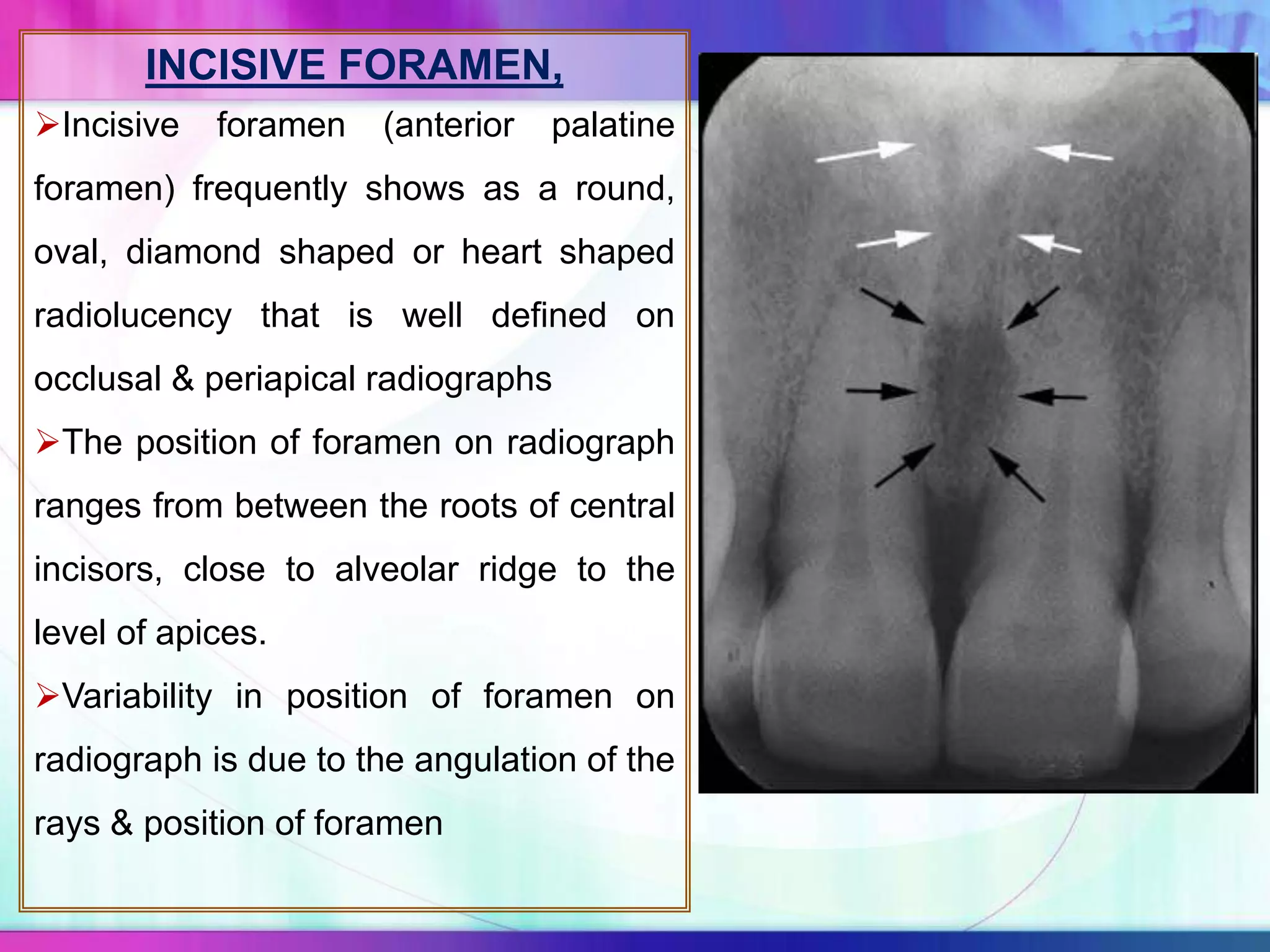 INCISIVE FORAMEN,
Incisive foramen (anterior palatine
foramen) frequently shows as a round,
oval, diamond shaped or heart shaped
radiolucency that is well defined on
occlusal & periapical radiographs
The position of foramen on radiograph
ranges from between the roots of central
incisors, close to alveolar ridge to the
level of apices.
Variability in position of foramen on
radiograph is due to the angulation of the
rays & position of foramen
 