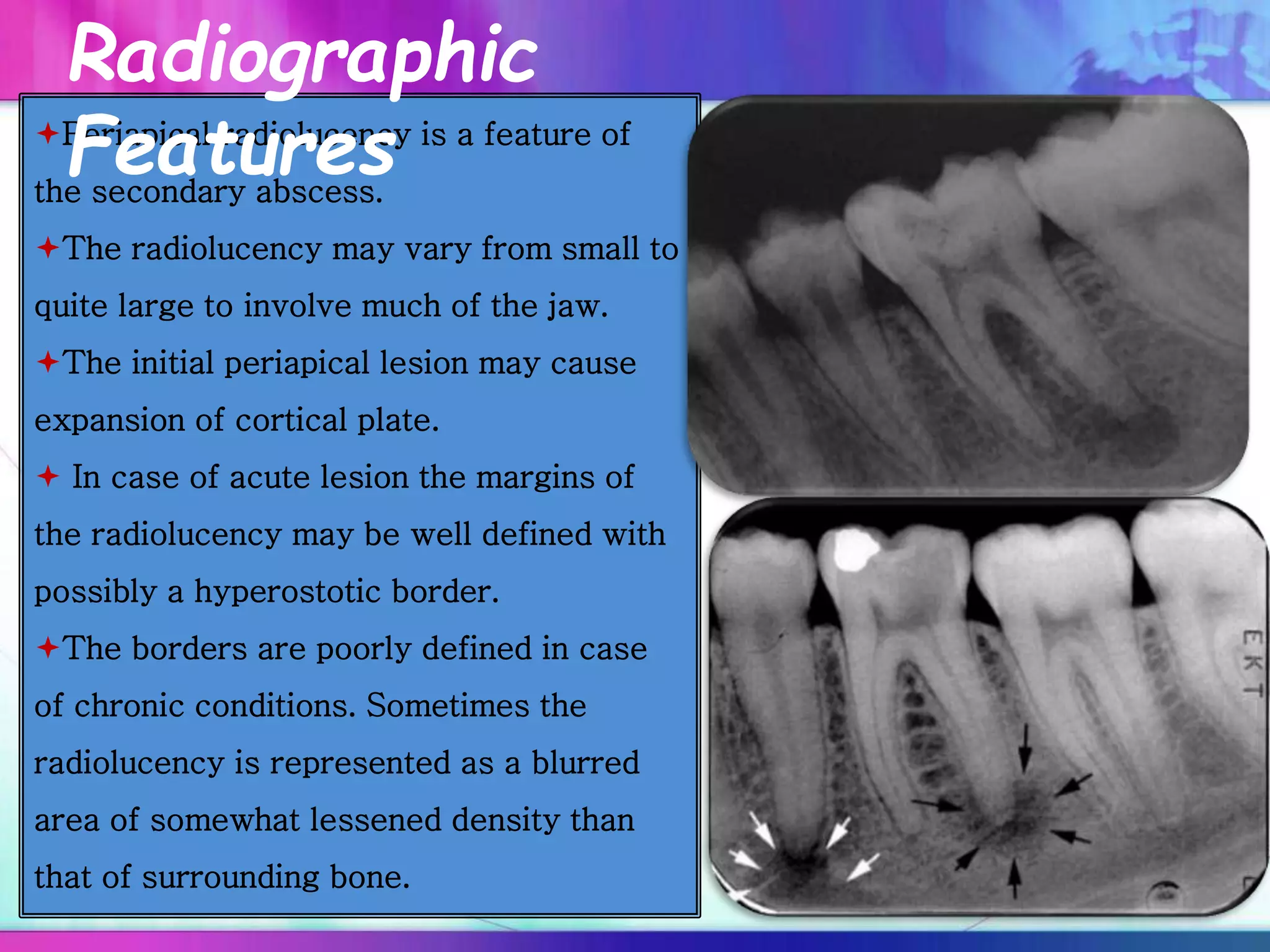 Periapical radiolucency is a feature of
the secondary abscess.
The radiolucency may vary from small to
quite large to involve much of the jaw.
The initial periapical lesion may cause
expansion of cortical plate.
 In case of acute lesion the margins of
the radiolucency may be well defined with
possibly a hyperostotic border.
The borders are poorly defined in case
of chronic conditions. Sometimes the
radiolucency is represented as a blurred
area of somewhat lessened density than
that of surrounding bone.
Radiographic
Features
 
