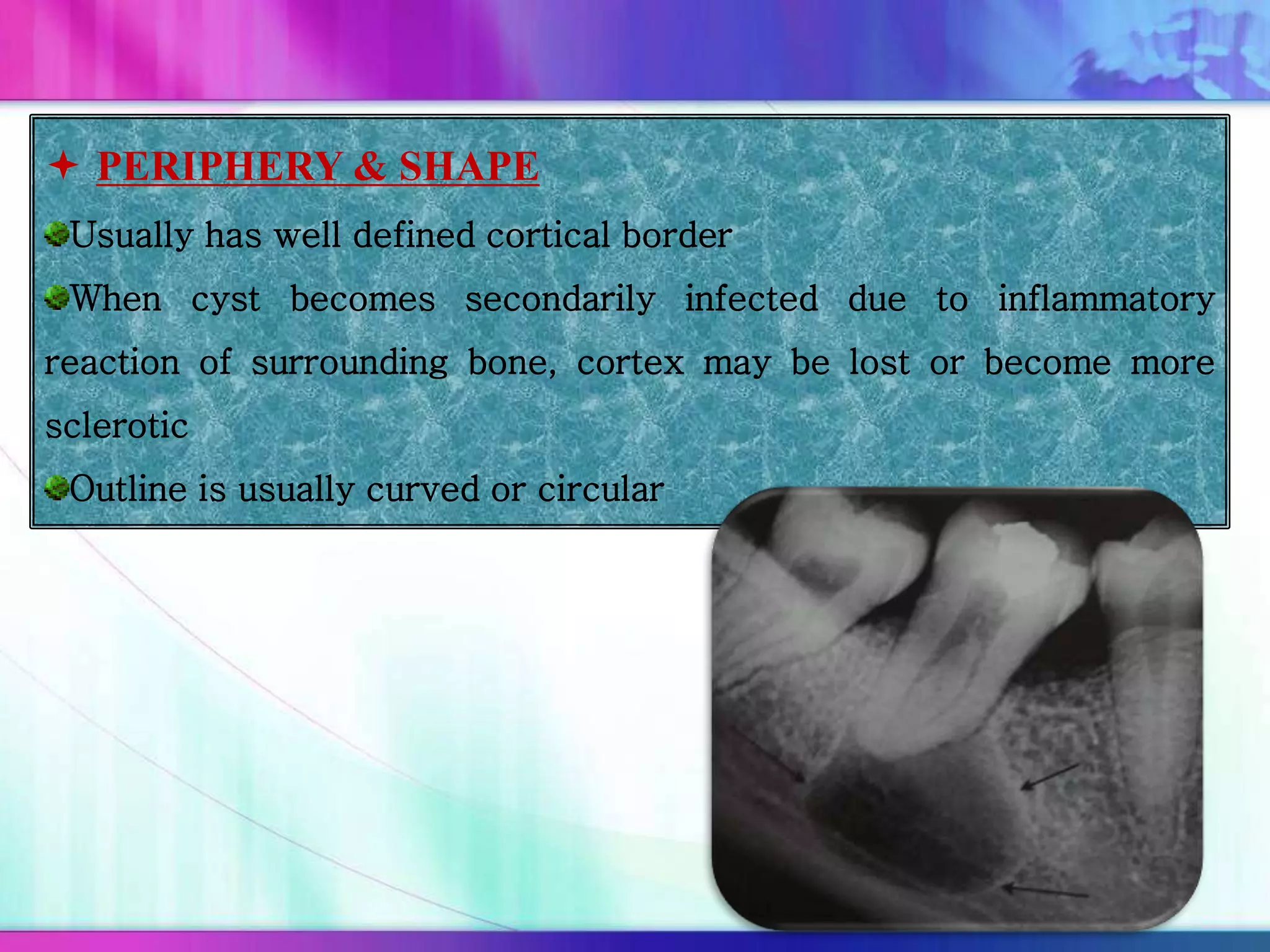  PERIPHERY & SHAPE
Usually has well defined cortical border
When cyst becomes secondarily infected due to inflammatory
reaction of surrounding bone, cortex may be lost or become more
sclerotic
Outline is usually curved or circular
 