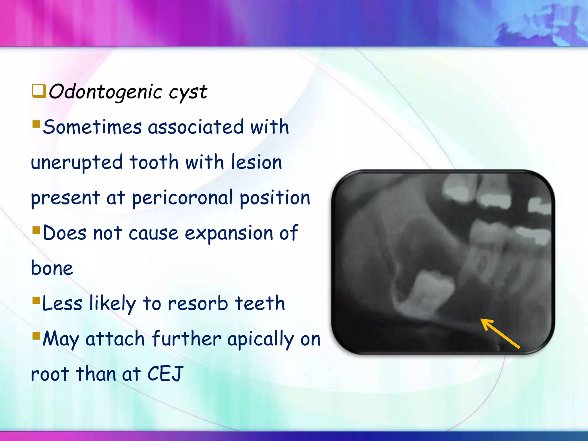 Odontogenic cyst
Sometimes associated with
unerupted tooth with lesion
present at pericoronal position
Does not cause expansion of
bone
Less likely to resorb teeth
May attach further apically on
root than at CEJ
 