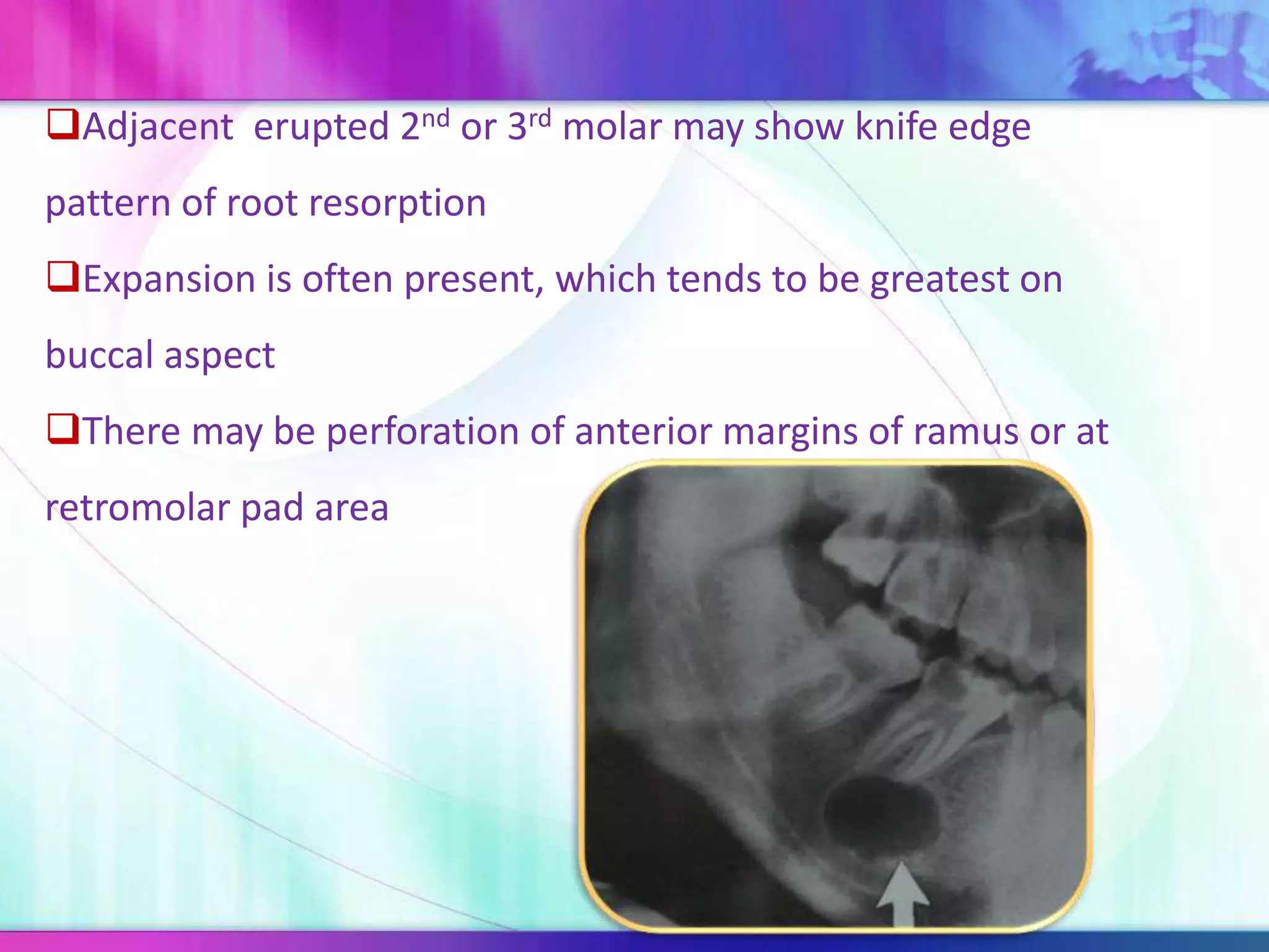 Adjacent erupted 2nd or 3rd molar may show knife edge
pattern of root resorption
Expansion is often present, which tends to be greatest on
buccal aspect
There may be perforation of anterior margins of ramus or at
retromolar pad area
 