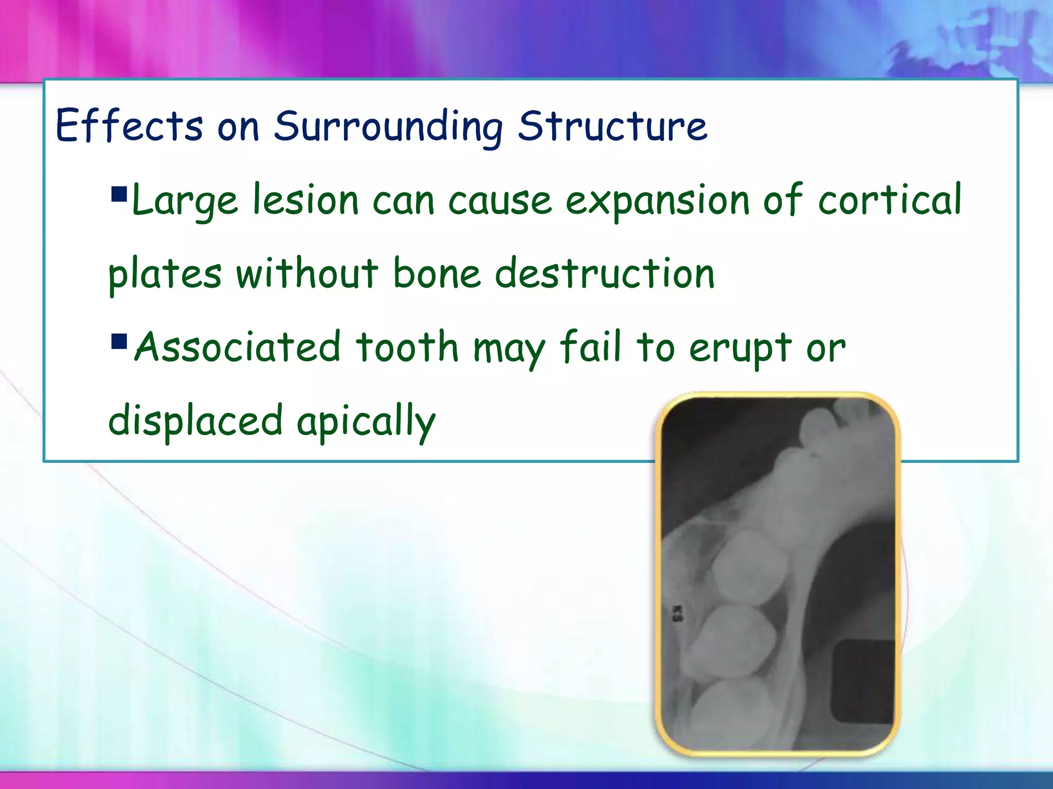Effects on Surrounding Structure
Large lesion can cause expansion of cortical
plates without bone destruction
Associated tooth may fail to erupt or
displaced apically
 
