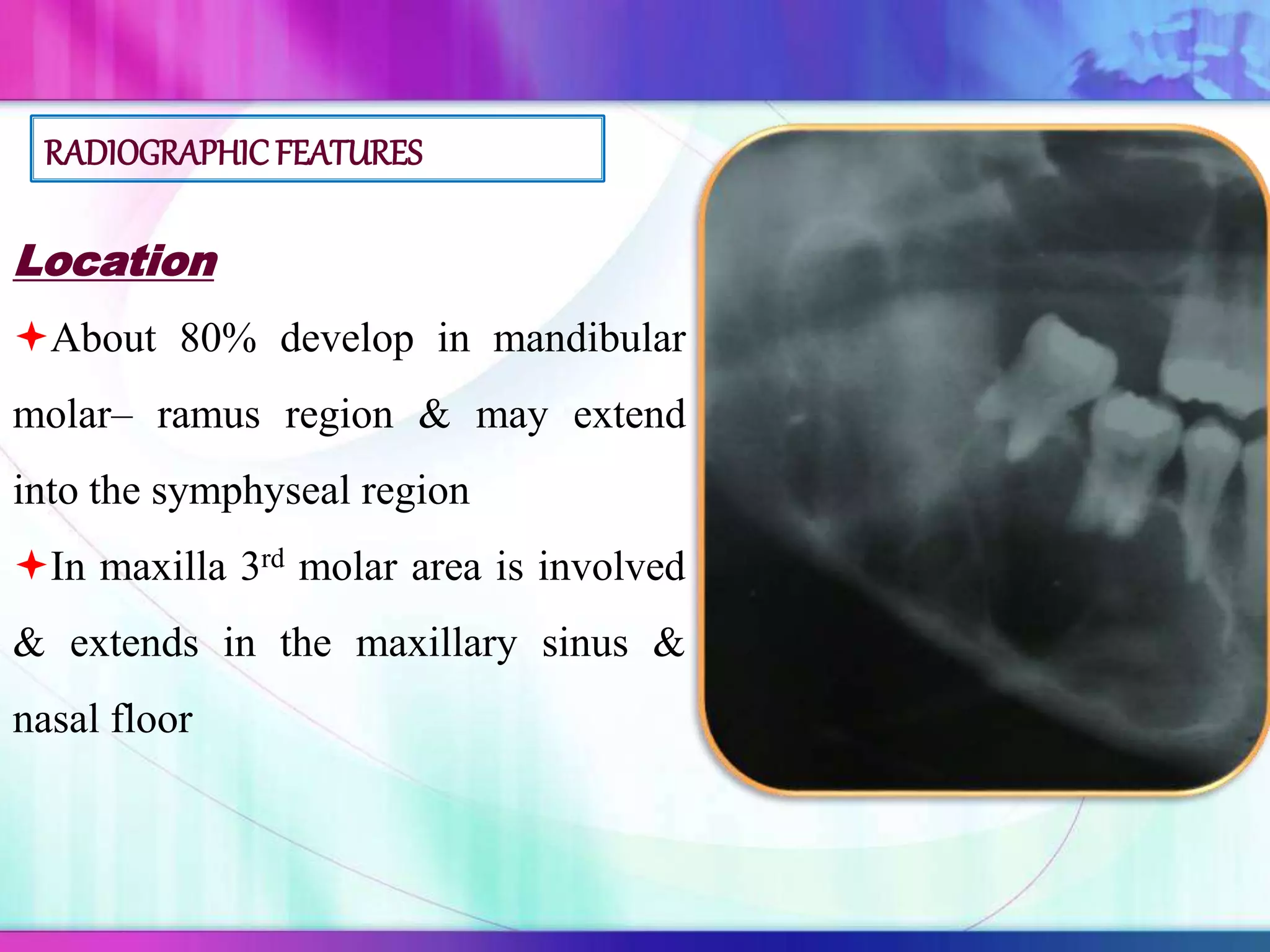 Location
About 80% develop in mandibular
molar– ramus region & may extend
into the symphyseal region
In maxilla 3rd molar area is involved
& extends in the maxillary sinus &
nasal floor
RADIOGRAPHIC FEATURES
 