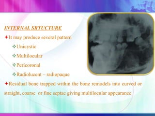 INTERNAL SRTUCTURE
It may produce several pattern
Unicystic
Multilocular
Pericoronal
Radiolucent – radiopaque
Residual bone trapped within the bone remodels into curved or
straight, coarse or fine septae giving multilocular appearance
 