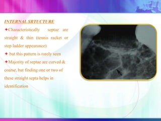 INTERNAL SRTUCTURE
Characteristically septae are
straight & thin (tennis racket or
step ladder appearance)
 but this pattern is rarely seen
Majority of septae are curved &
coarse, but finding one or two of
these straight septa helps in
identification
 
