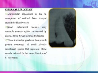 INTERNAL STRUCTURE
Multilocular appearance is due to
entrapment of residual bone trapped
around the blood vessels
Small radiolucent locules may
resemble marrow spaces surrounded by
coarse, dense & well defined trabeculae
These trabeculae produces honeycomb
pattern composed of small circular
radiolucent spaces that represent blood
vessels oriented in the same direction of
x- ray beams
 
