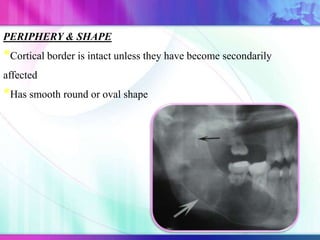 PERIPHERY & SHAPE
*Cortical border is intact unless they have become secondarily
affected
*Has smooth round or oval shape
 